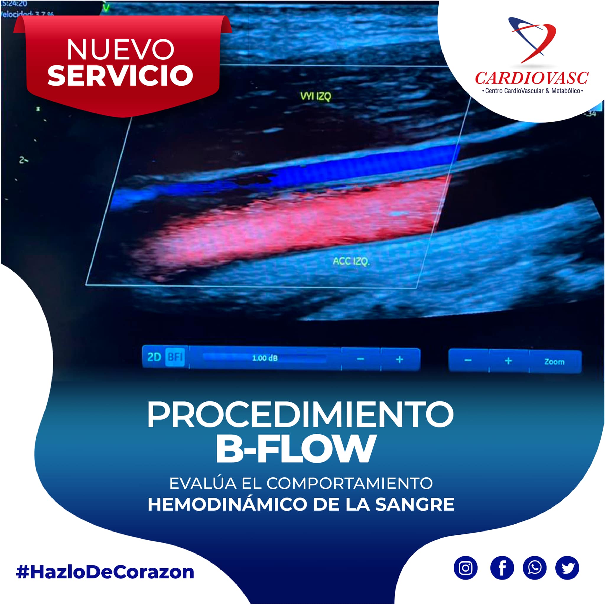 CardioVasc Uio - ️El procedimiento B-FLOW observa...