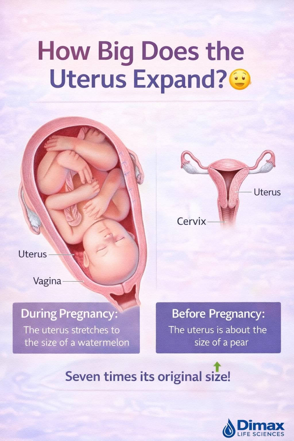 What Size Is Uterus Human Arteriovenous Malformation Of The Uterus