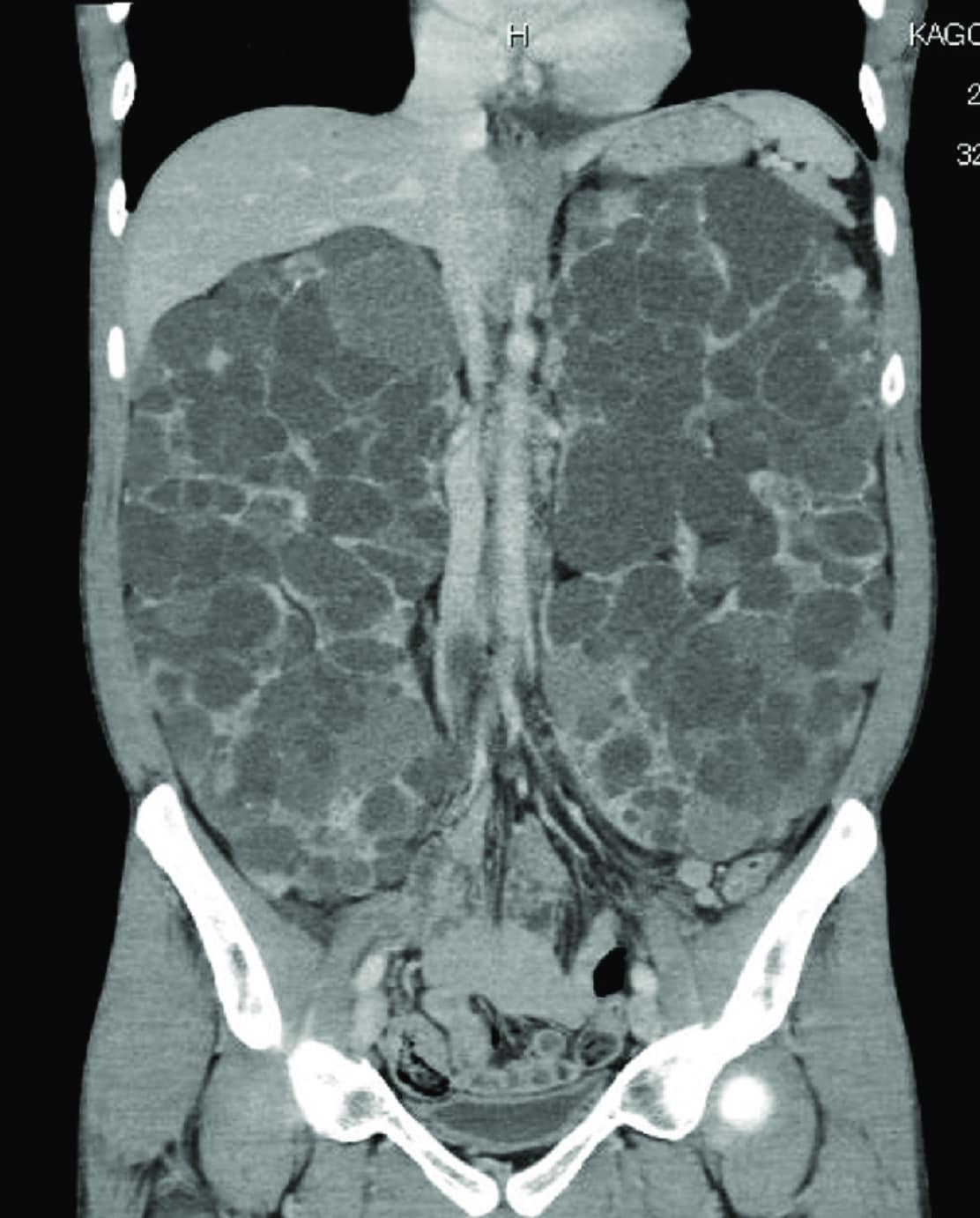 Medical - This patient presented with kidney failure. What is your ...