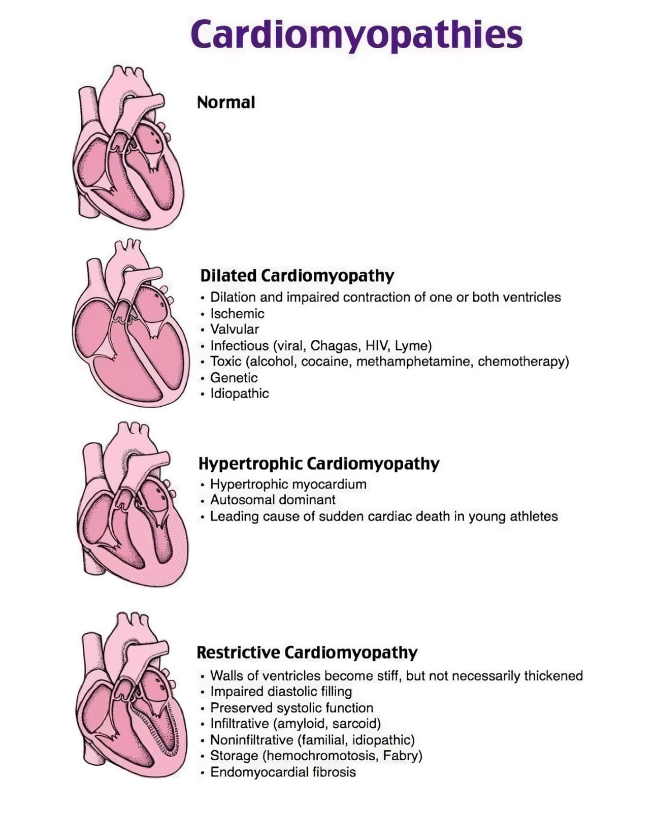Hypertrophic Cardiomyopathy Vs Other Heart Conditions