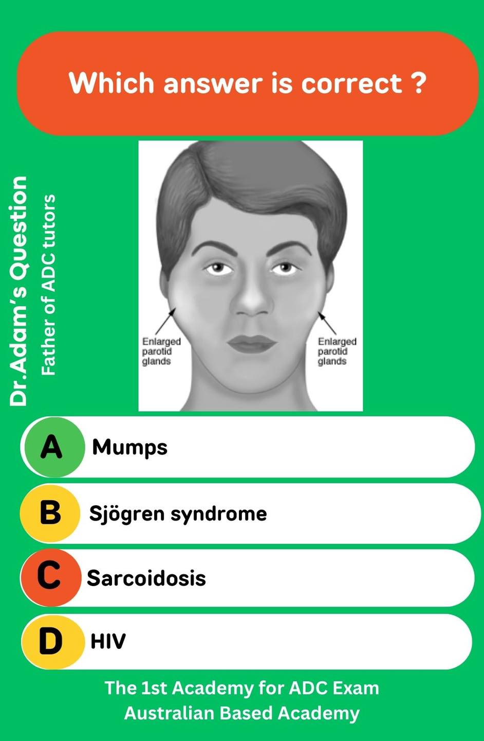 Comment below ⬇️ Which disease is characterized by bilateral parotid ...