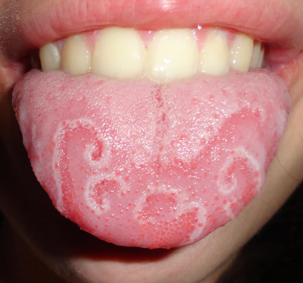 best melanotan Melanotan II (Tan Jabs): Why They're Not Worth The Risk