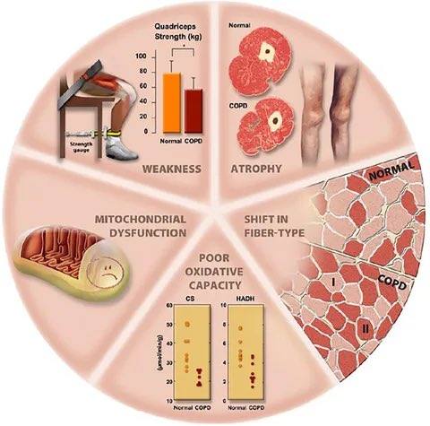 Potential abnormalities in... - Nutrición en Adolescentes