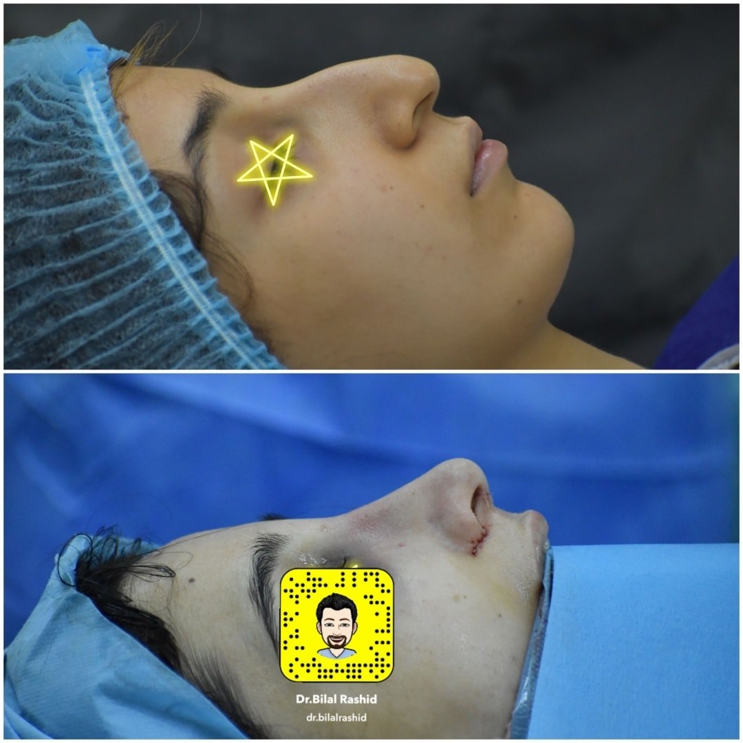 Dr.Bilal Rashid | Ranya