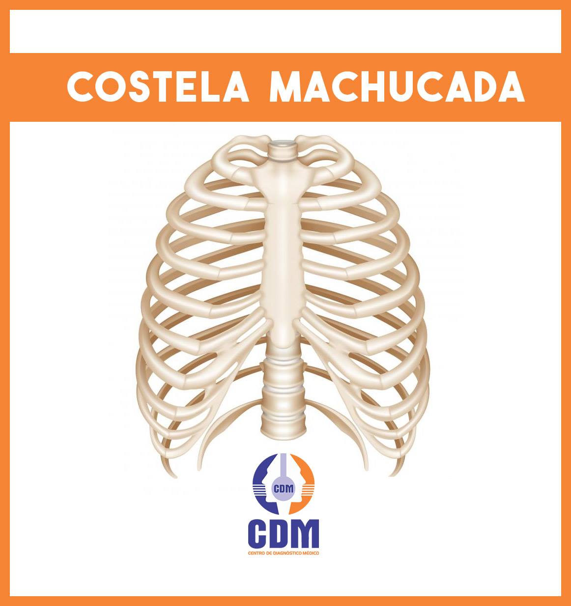 CDM - DORES NAS COSTELAS? Certifique-se de não ter quebrado as costelas ...