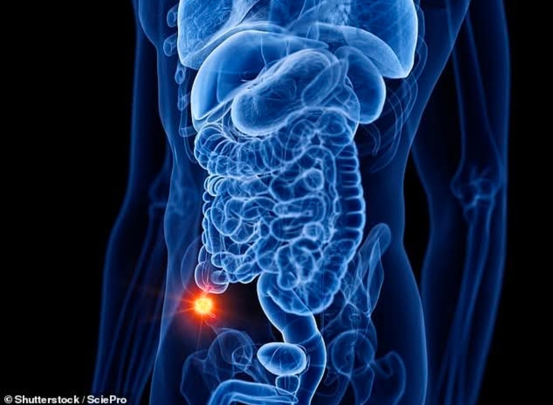 Biblical - THE APPENDIX IS USEFUL Doctors over the last 150 years have ...