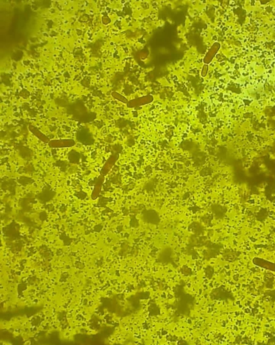 Superrito - En heces no solo encontramos bacterias o...