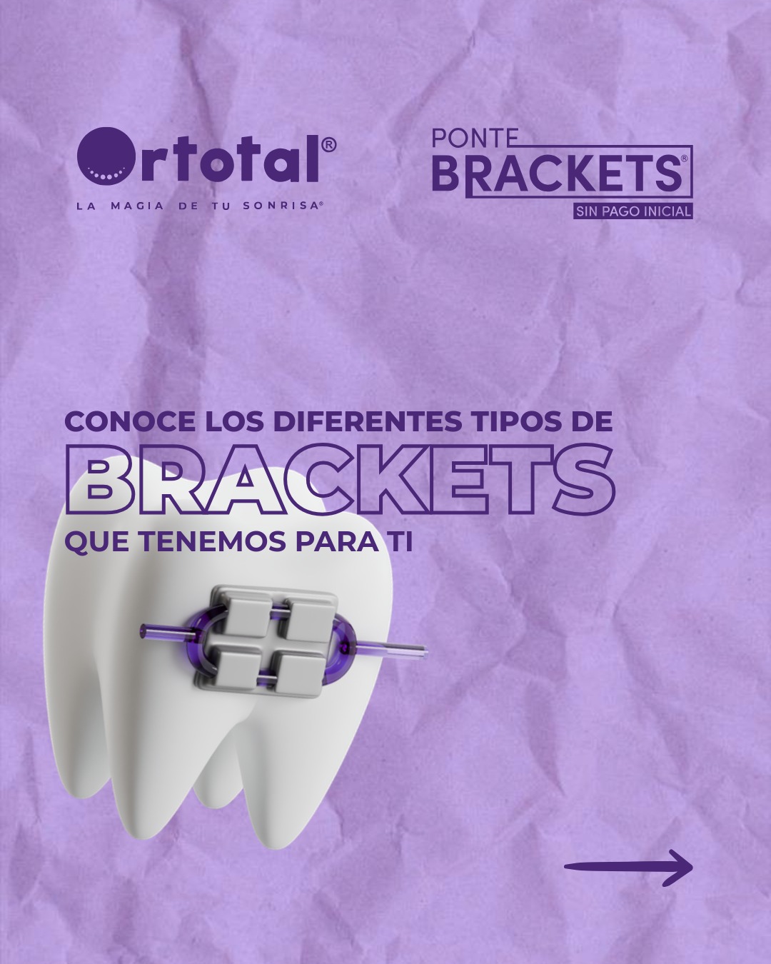 🦷 ¿Sabes qué tipo de brackets es... - Ortotal Santa Rosa | Facebook