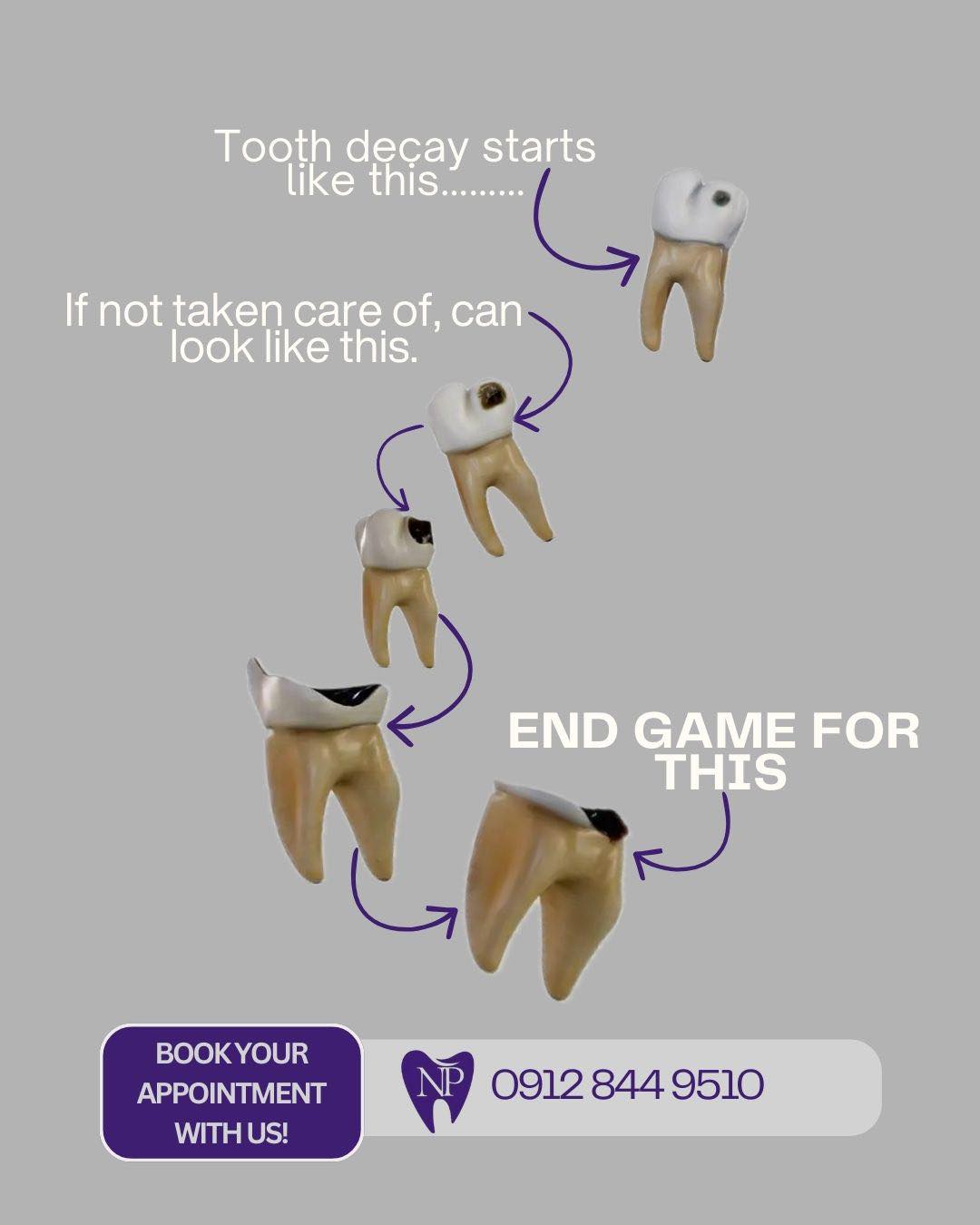 DID YOU KNOW? 🧐 Small cavity ➡️ Big problem. Don't wait until