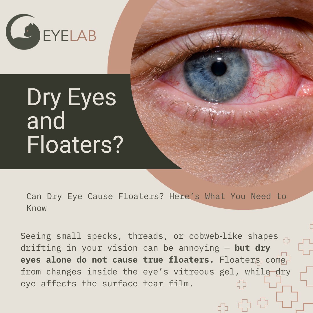 👁️ Seeing floaters in your vision? Here's what you need to know. Those small specks, threads, or cobweb‑like shapes drifting across your sight can be annoying — but dry eyes alone do