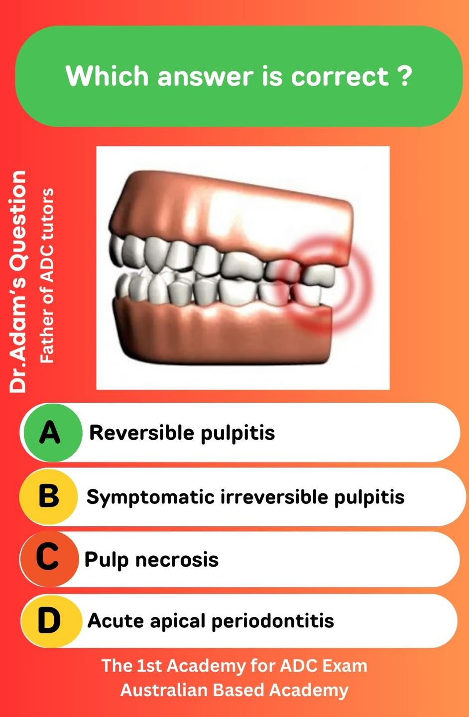 Comment below ⬇️ A patient presents with discomfort in a posterior ...