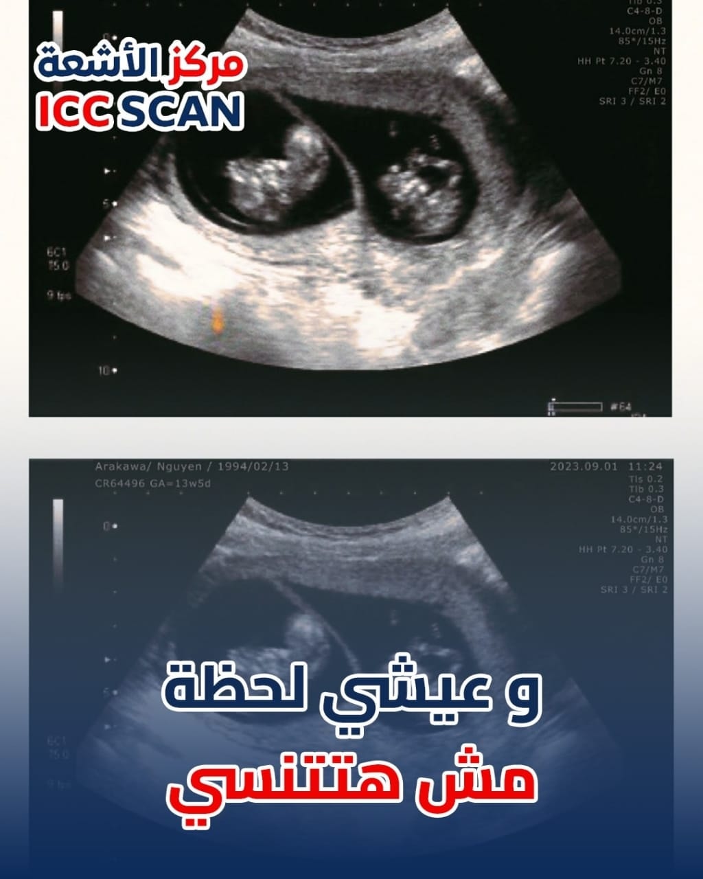 شاكة إنك حامل فى... - ICC Scan - مركز الأشعة آي سي سي سكان | Facebook