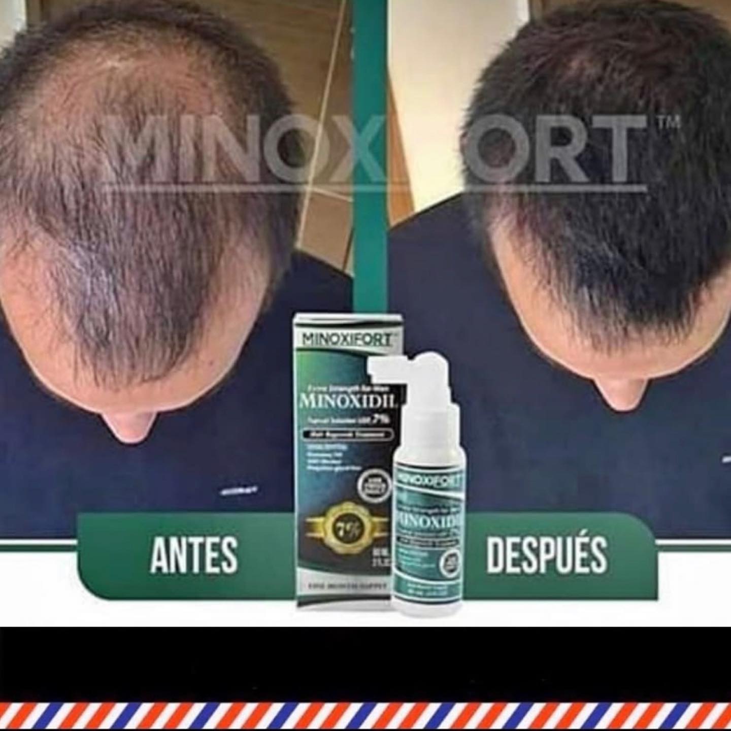 Minoxidil al 7% + domicilio... - Central Del Barbero