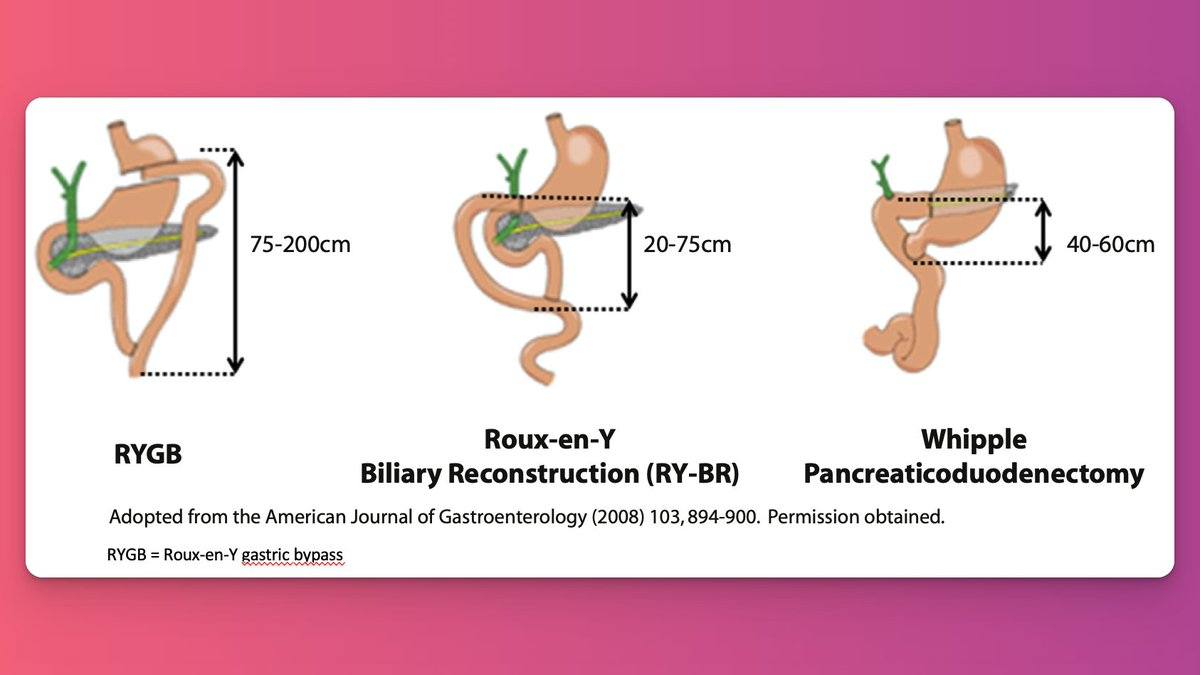 EndoCollab - It is important to know how long the small bowel limbs are ...