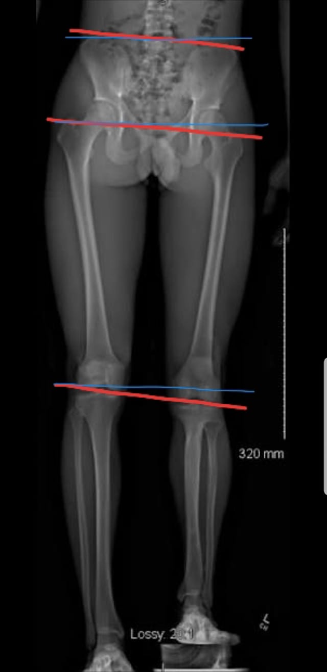 Scanogram!... - Prohuman Physiotherapy & Fitness- Dr Hemali M | Facebook