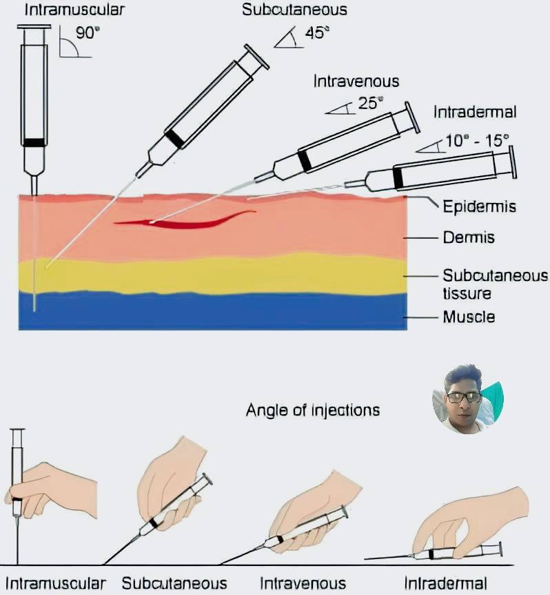 Medical - 💉TYPES Of INJECTION Explained! 😱😱💉💉🩺🧑🏻‍⚕️... | Facebook