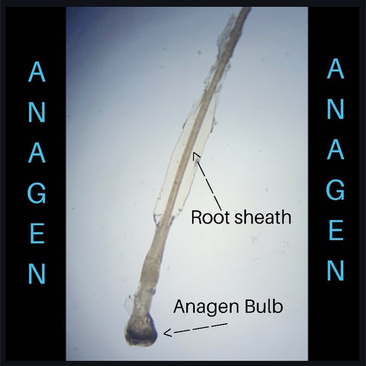 Hair Root Under Microscope