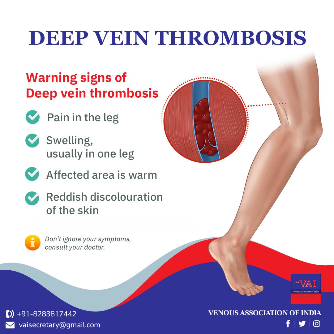 Deep vein thrombosis is a... - Venous Association of India | Facebook