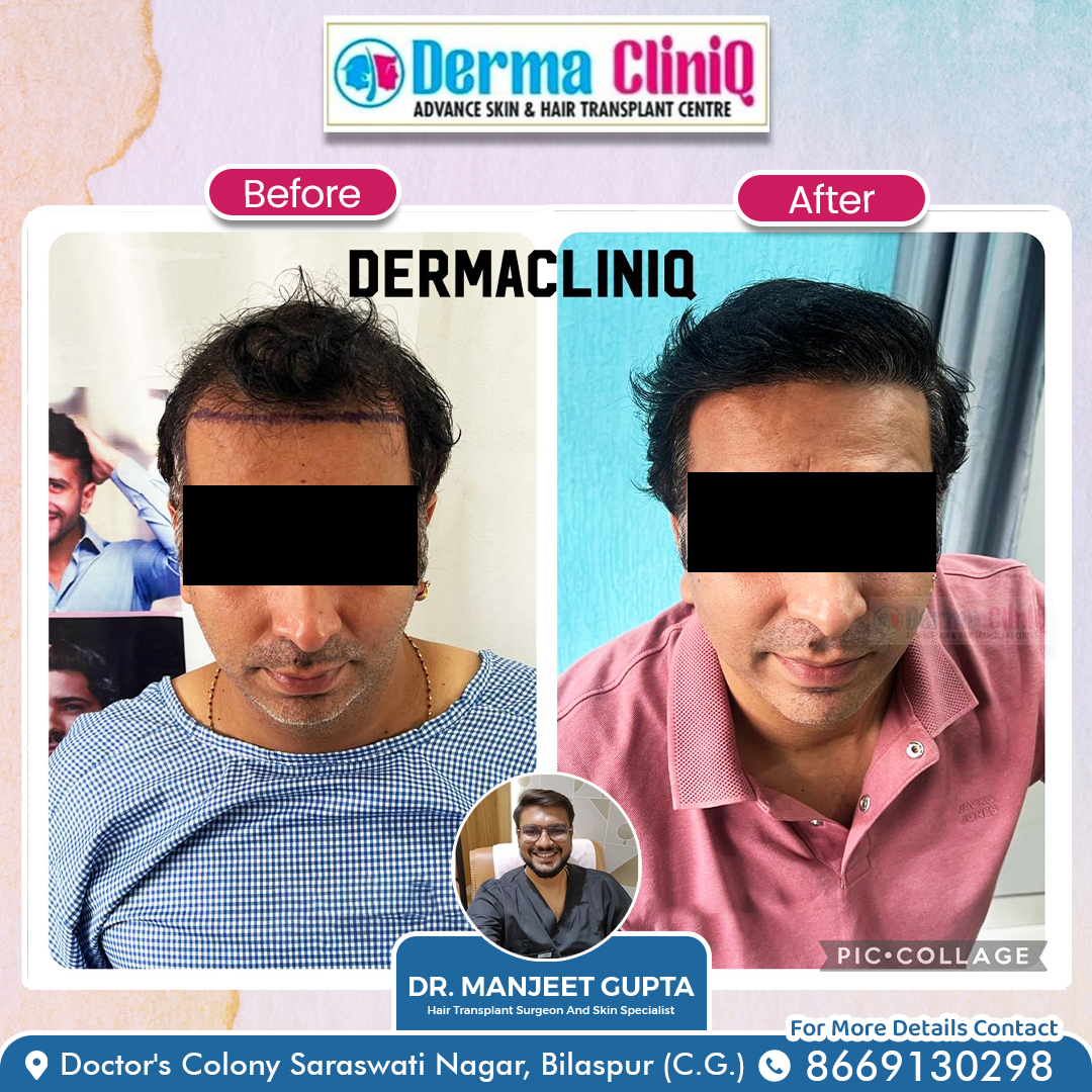 Dermacliniq | Bilaspur
