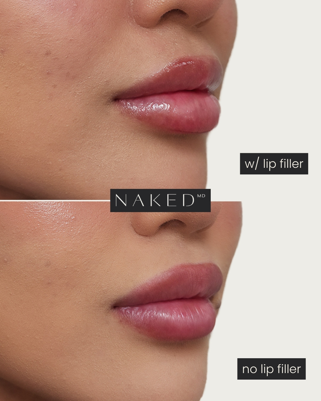 NAKEDᴹᴰ