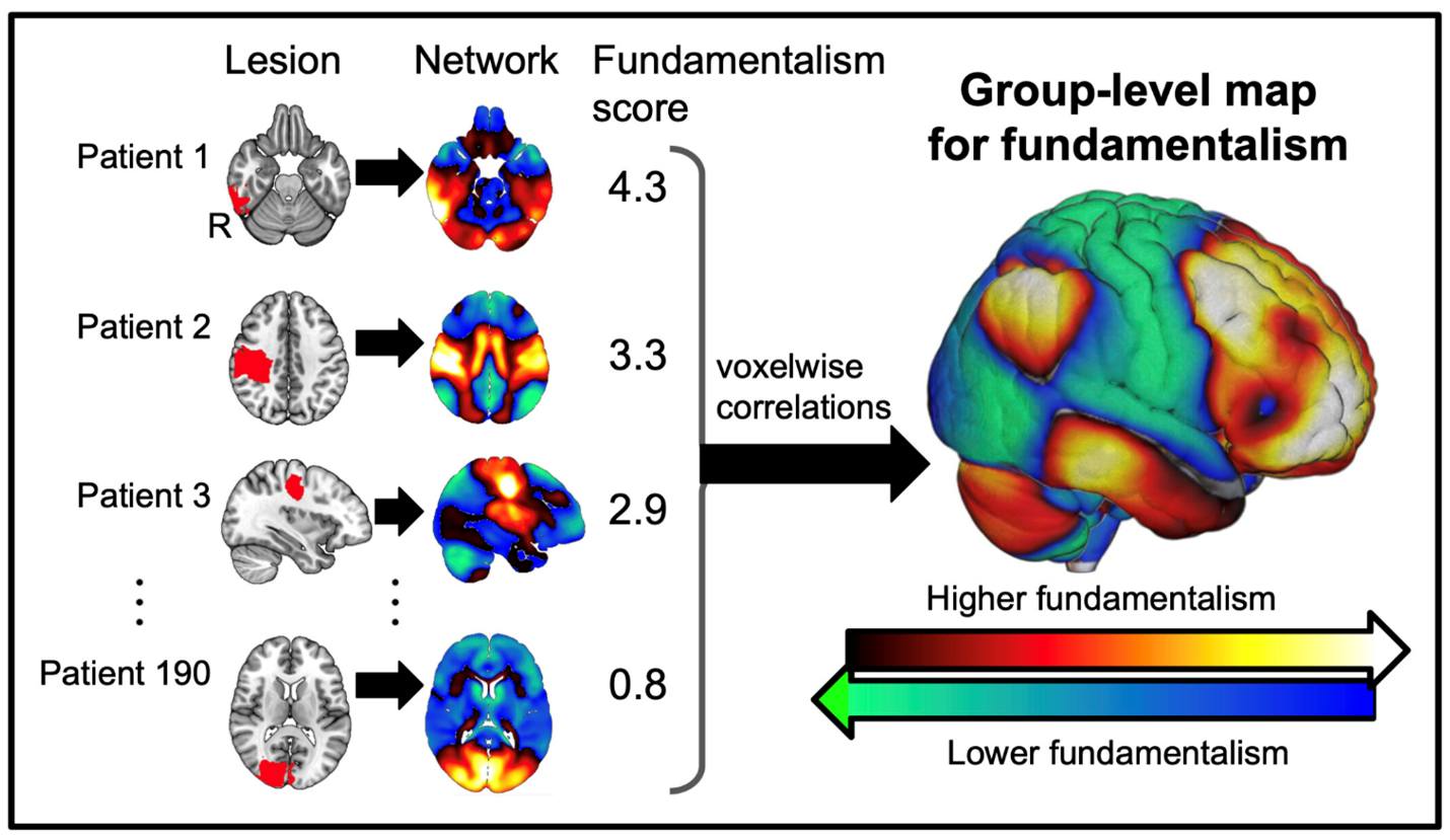 PNAS - An analysis of 190 patients with brain lesions found that ...