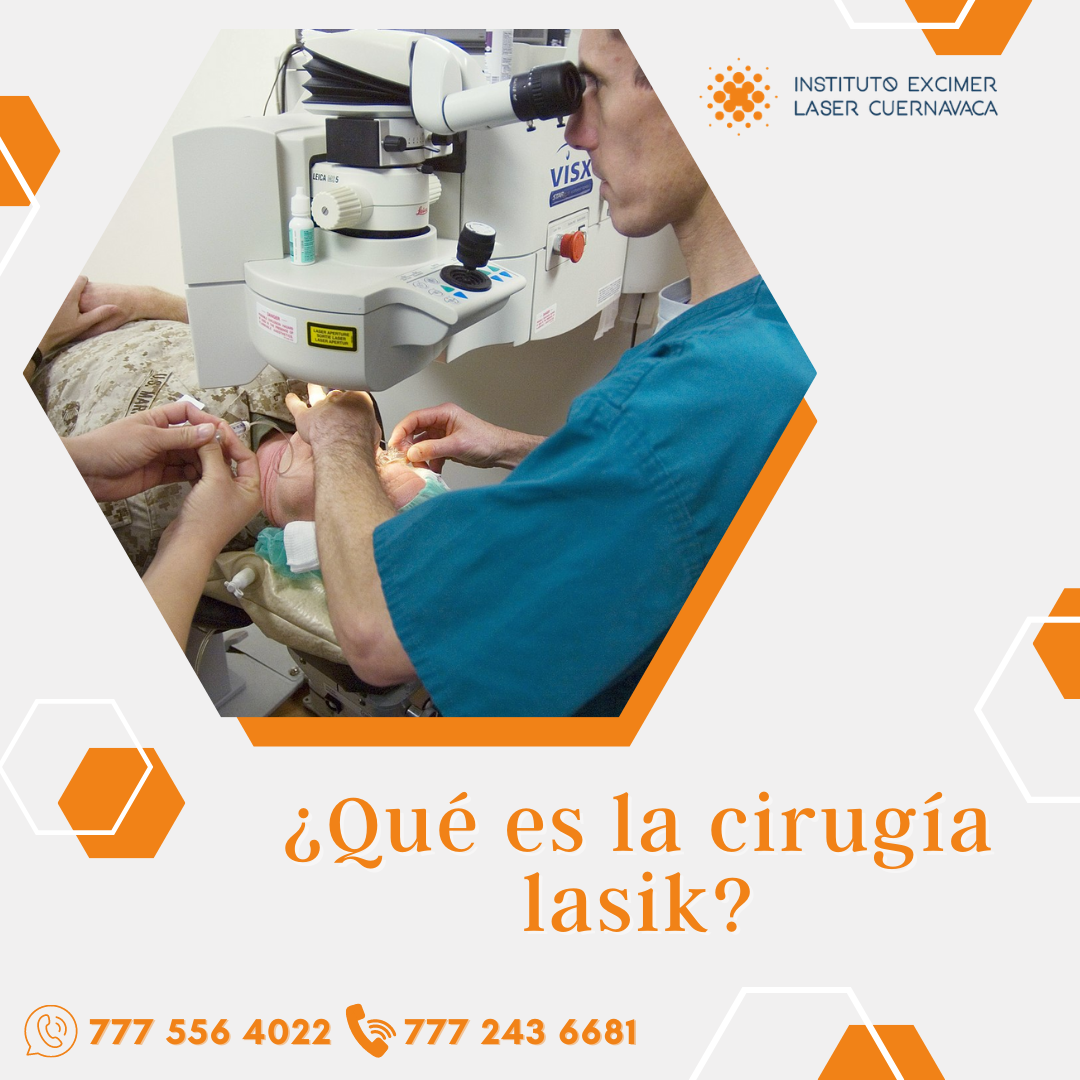 Es una cirugía de los... - Instituto Excimer Láser Cuernavaca