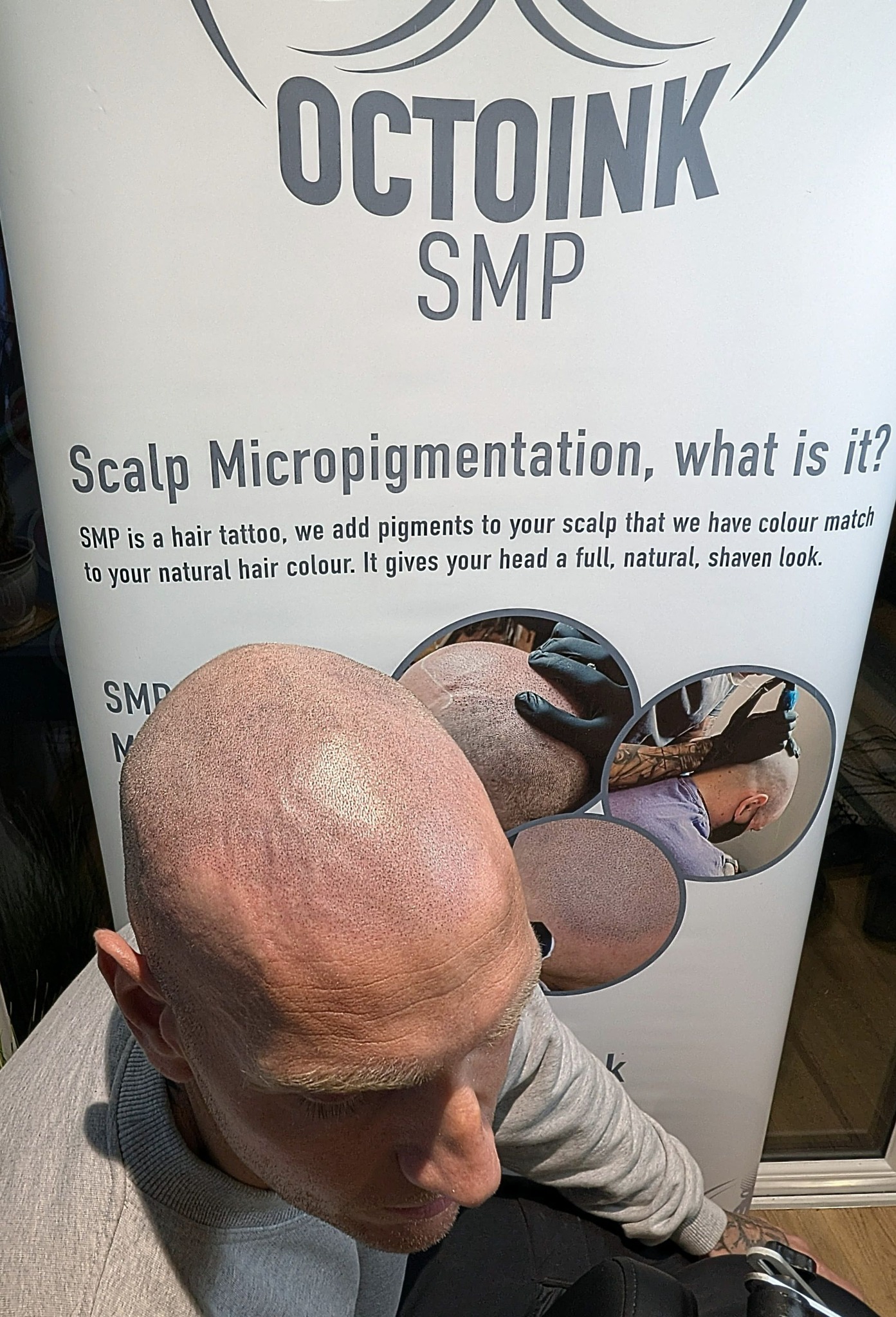 Octoink Scalp Micropigmentation