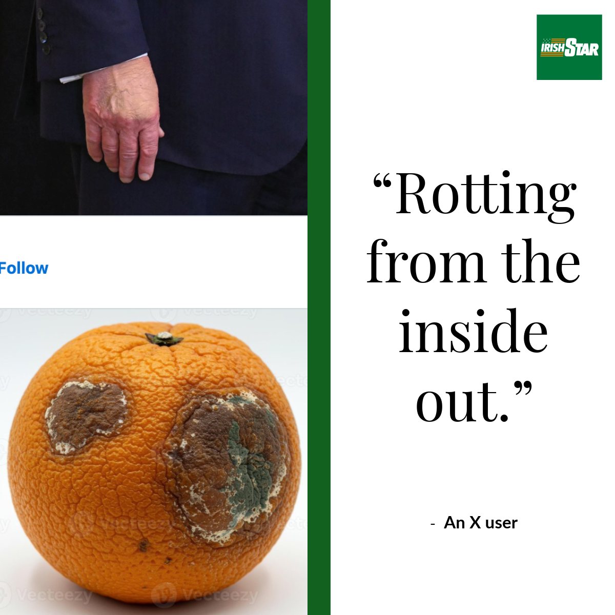 Trump covered the bruise on his hand with mismatched makeup and 