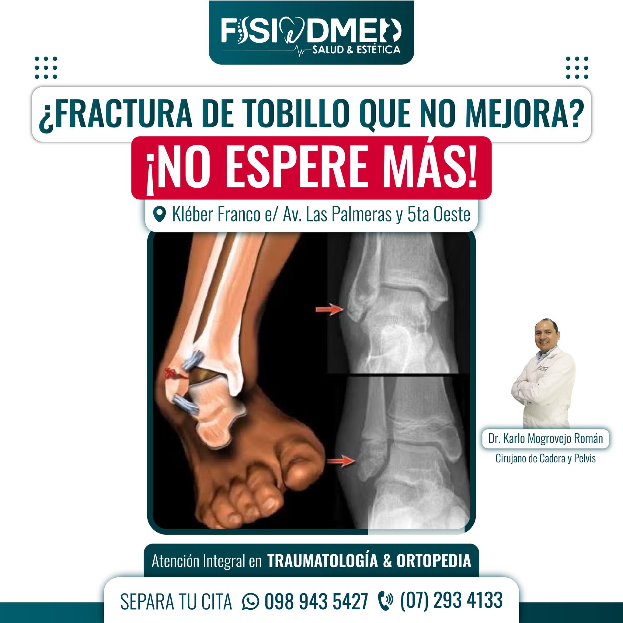 Fisiodmed - ¿Tu tobillo roto no sana? 🦶🤕 ¿Llevas semanas... | Facebook