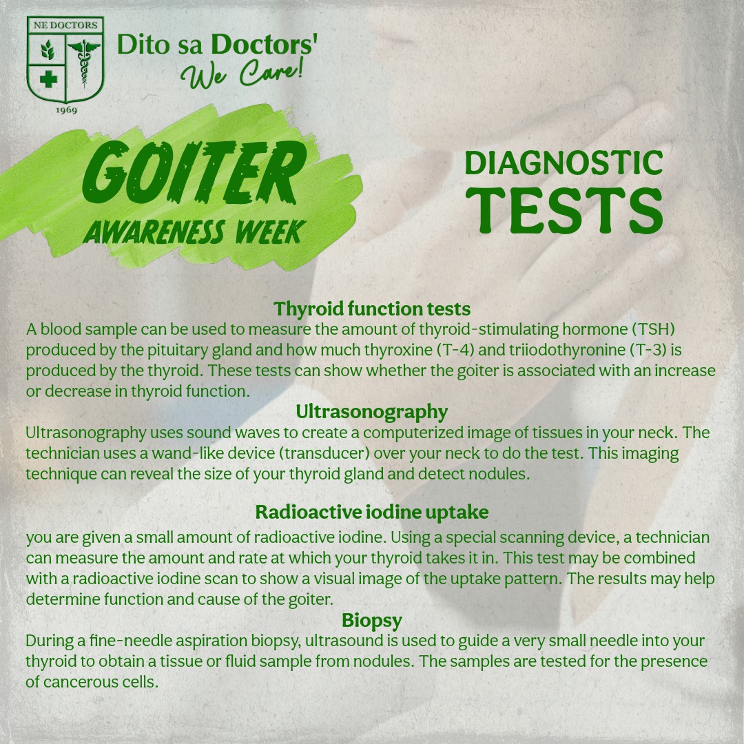 A goiter is often... - Nueva Ecija Doctors Hospital