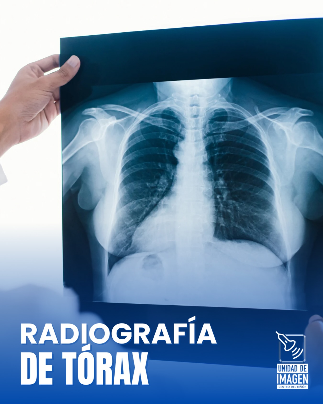 Anatomía Del Tórax Por Rayos X ABC Radiografía De Tórax