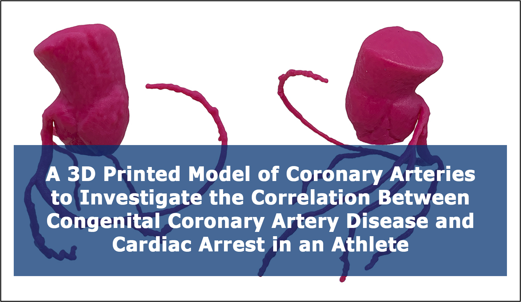 3d4med - A 3D Printed Model of Coronary Arteries to... | Facebook