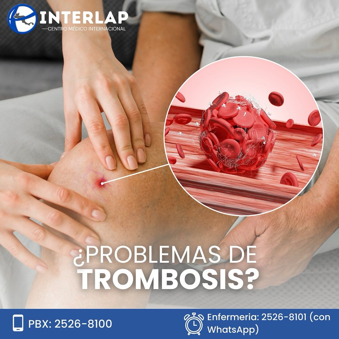 La trombosis es... - Interlap - Centro Médico Internacional | Facebook