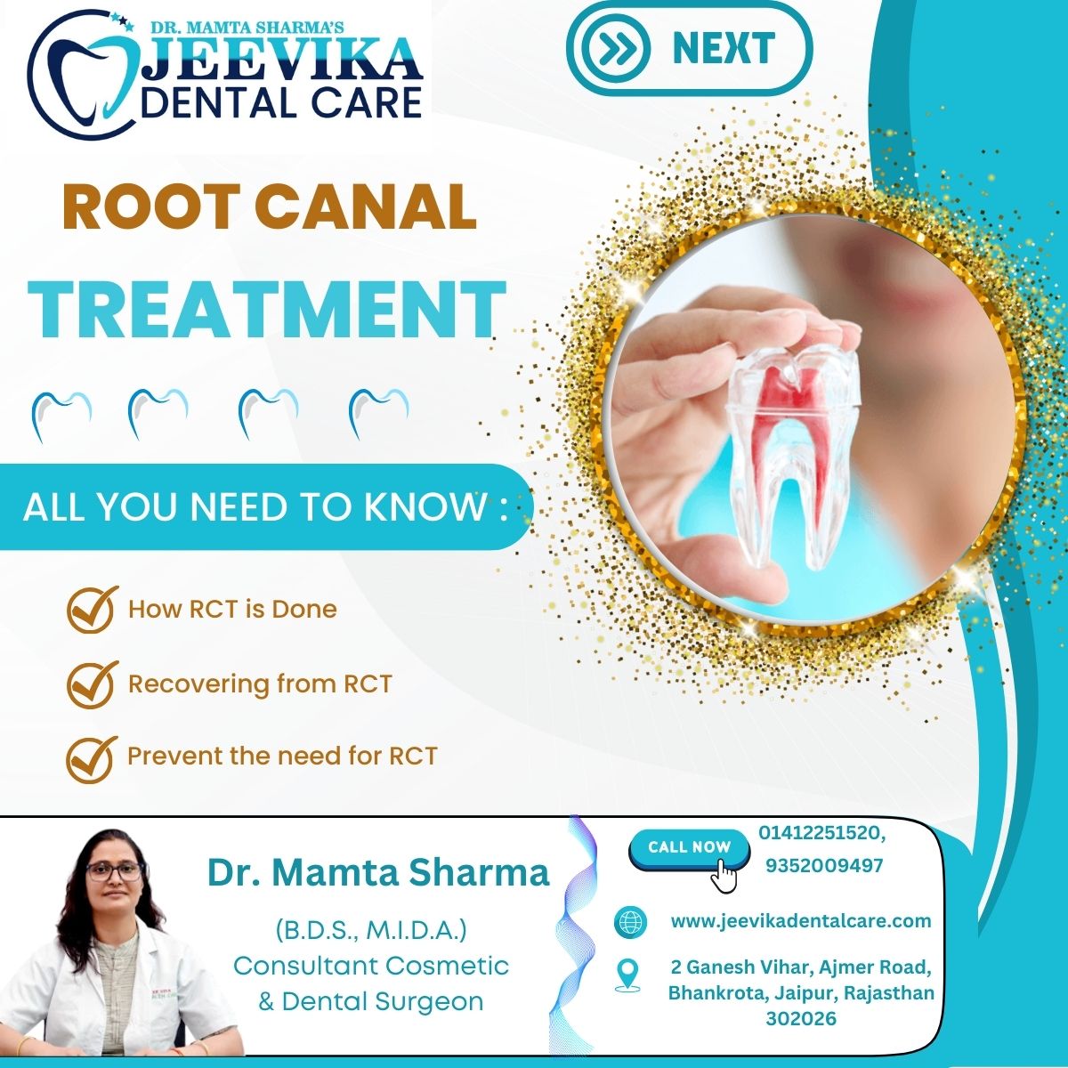 Jeevika - 🦷 💉 ROOT CANAL TREATMENT : 💁‍♀️ ALL YOU NEED TO KNOW: - How ...