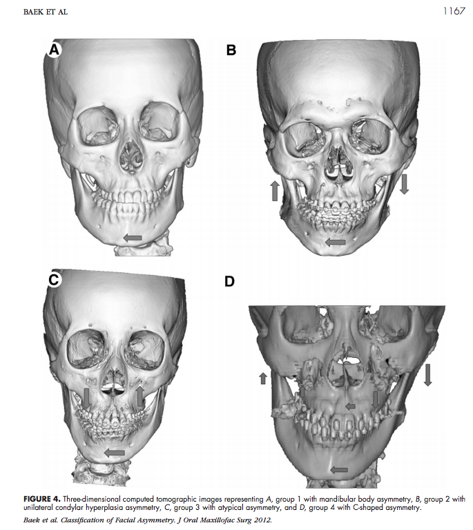 FACES LAB - morphological classification of facial asymmetry