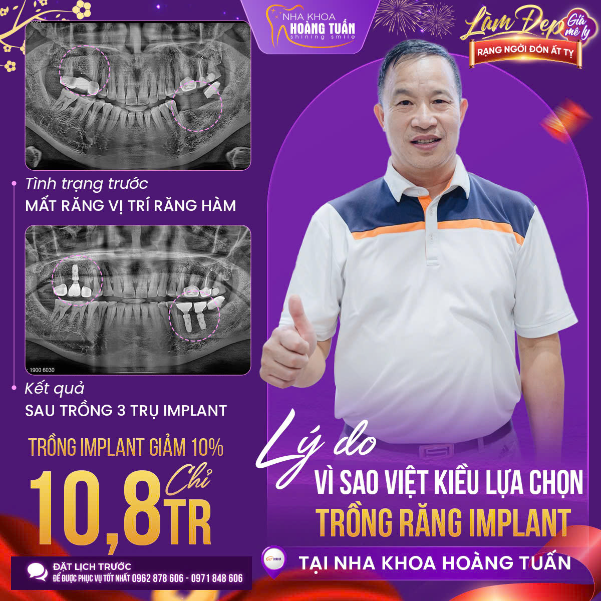 Hệ Thống Phòng Khám Nha Khoa - Hoàng Tuấn - VIỆT KIỀU TRỞ VỀ NƯỚC TRỒNG ...