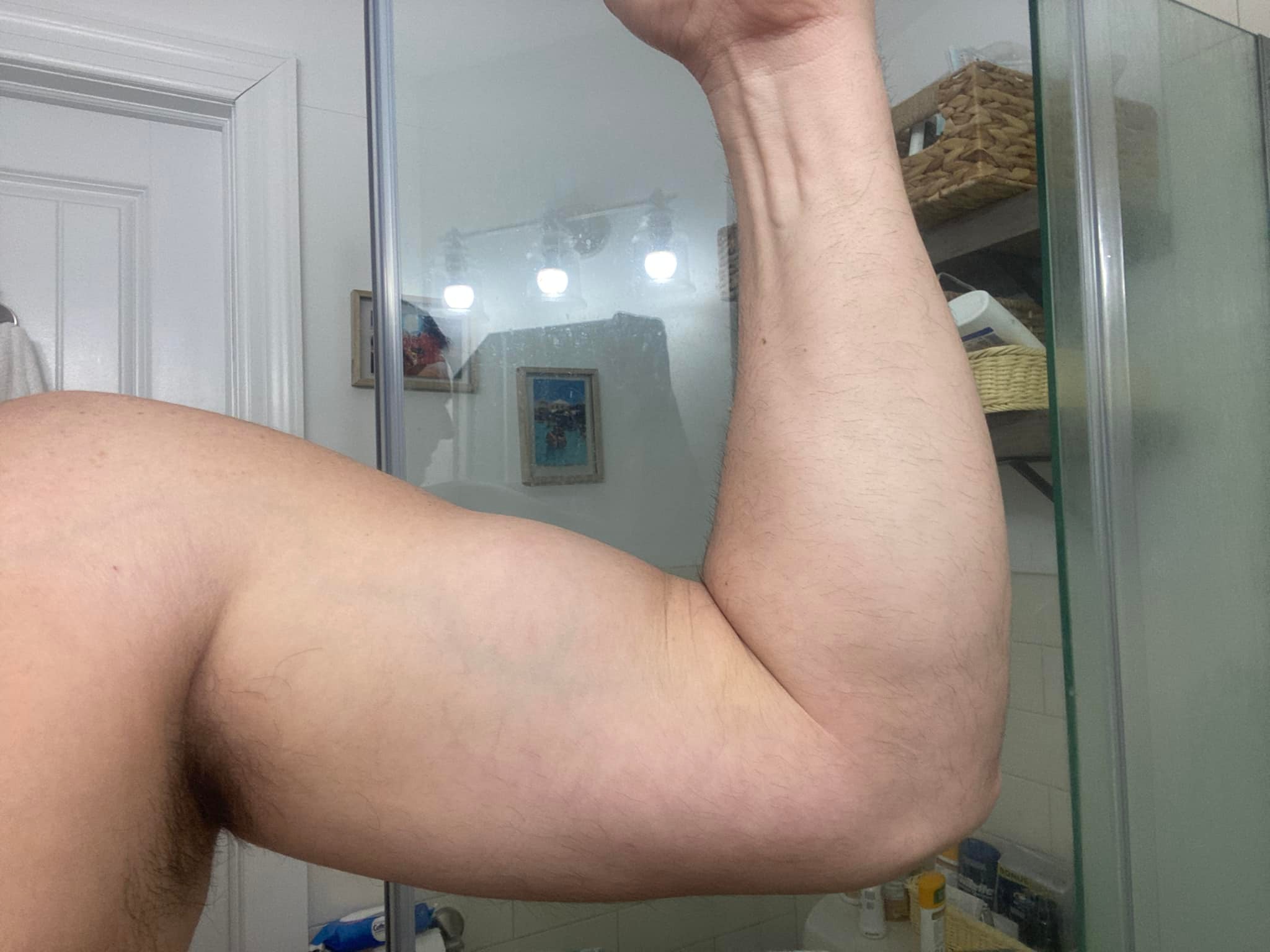 bpc 157 bicep tendonitis reddit Should I have surgery for a partially torn distal tendon at 40 years old? phosphatyidlcholine