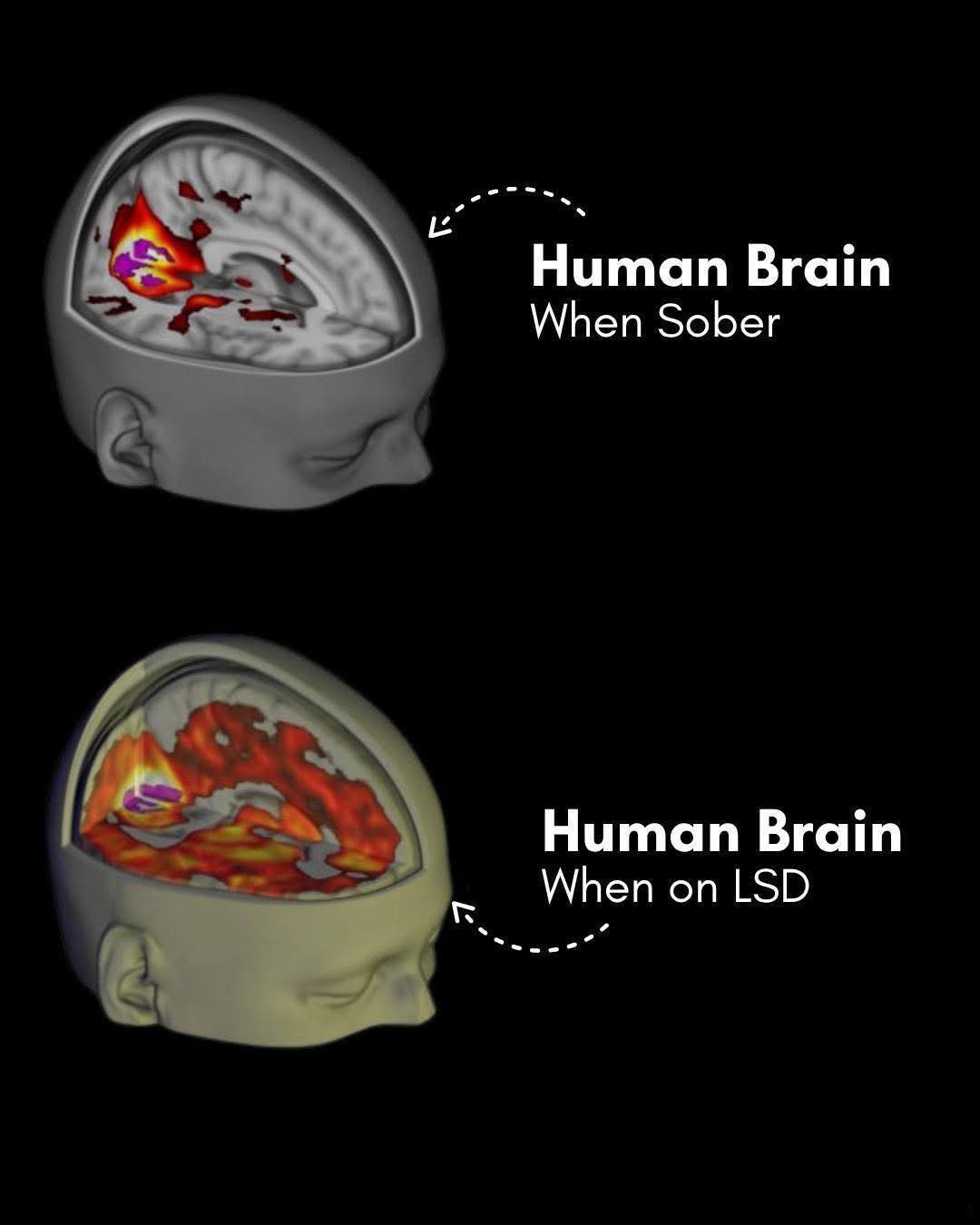 Science - 🧠 World-first brain scans reveal how LSD reshapes the human ...