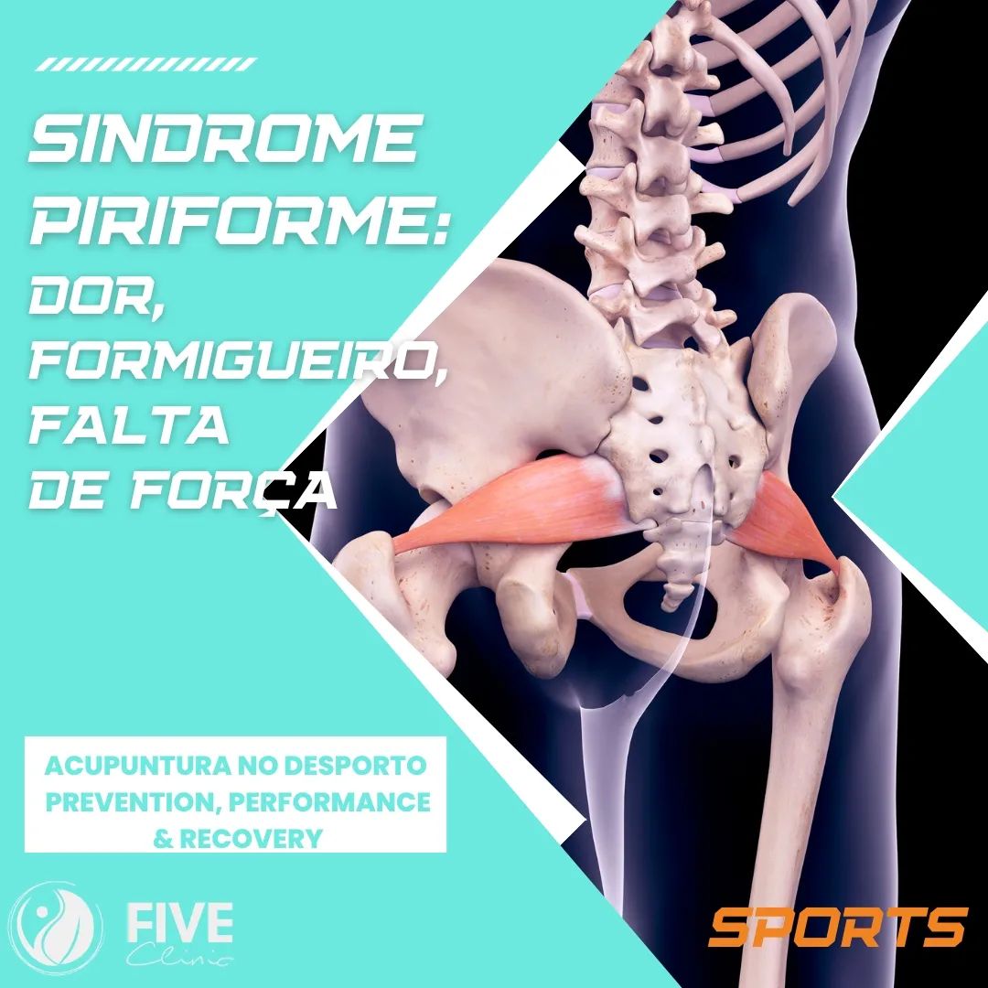 Five Clinic - SÍNDROME DO PIRIFORME: Como Tratar com a...