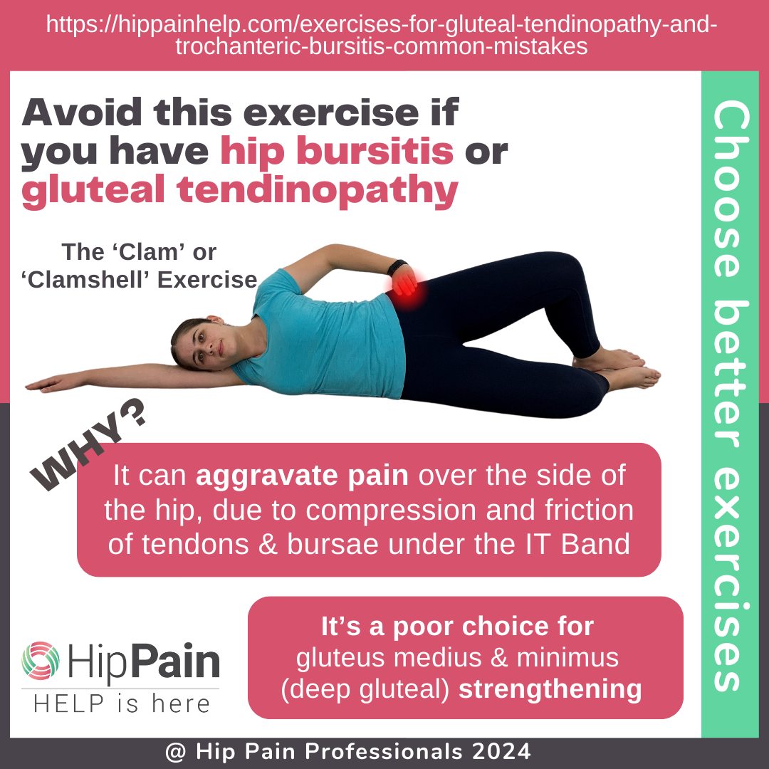 Hip Pain Help - Doing clam exercises for your hip? Avoid... | Facebook