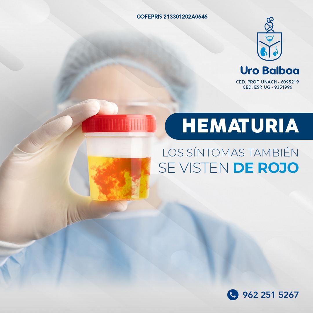 La hematuria, o presencia de sangre en la orina, puede ser un indicador ...