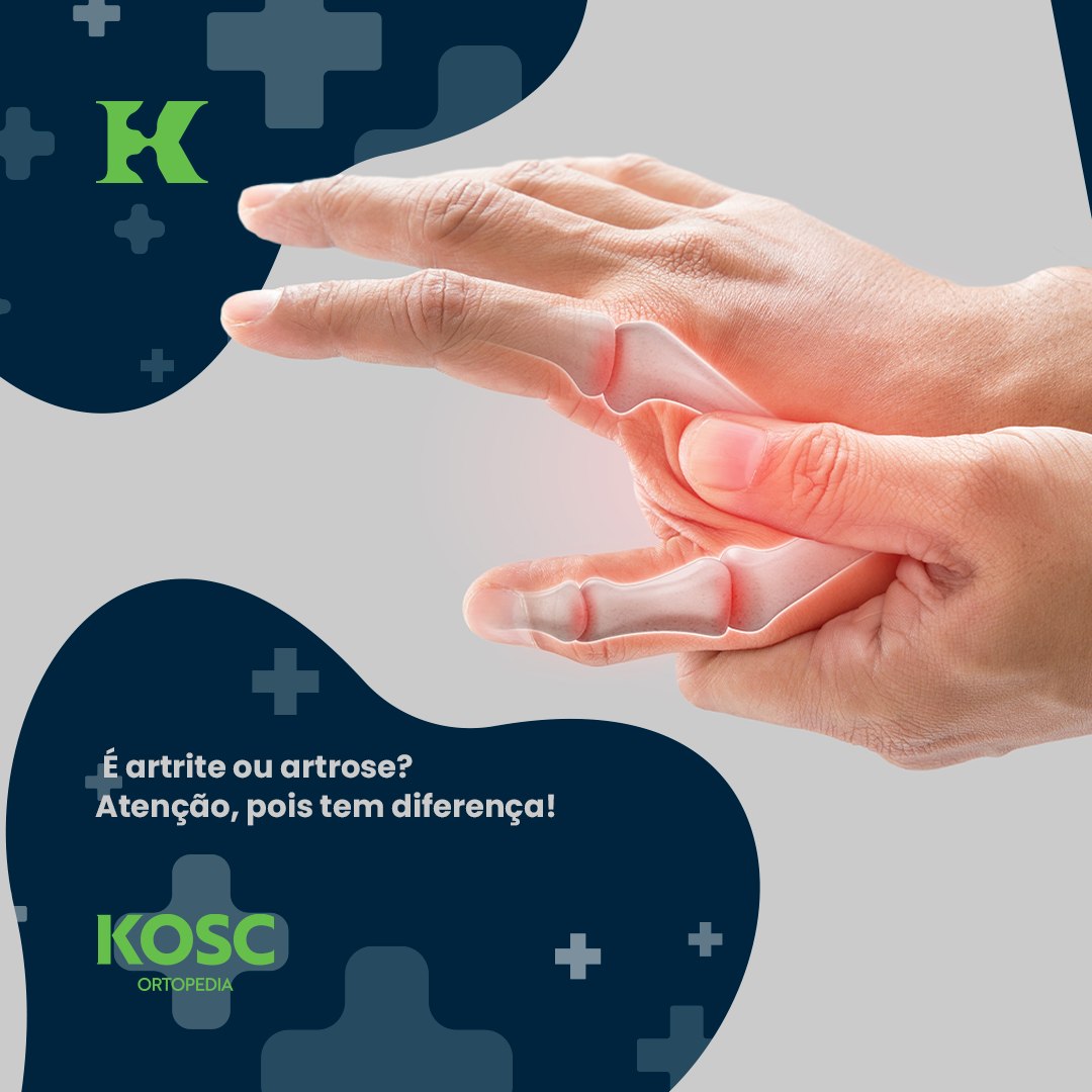 kosc-a-semelhan-a-nos-nomes-pode-confundir-mas-esses-s-o-dois