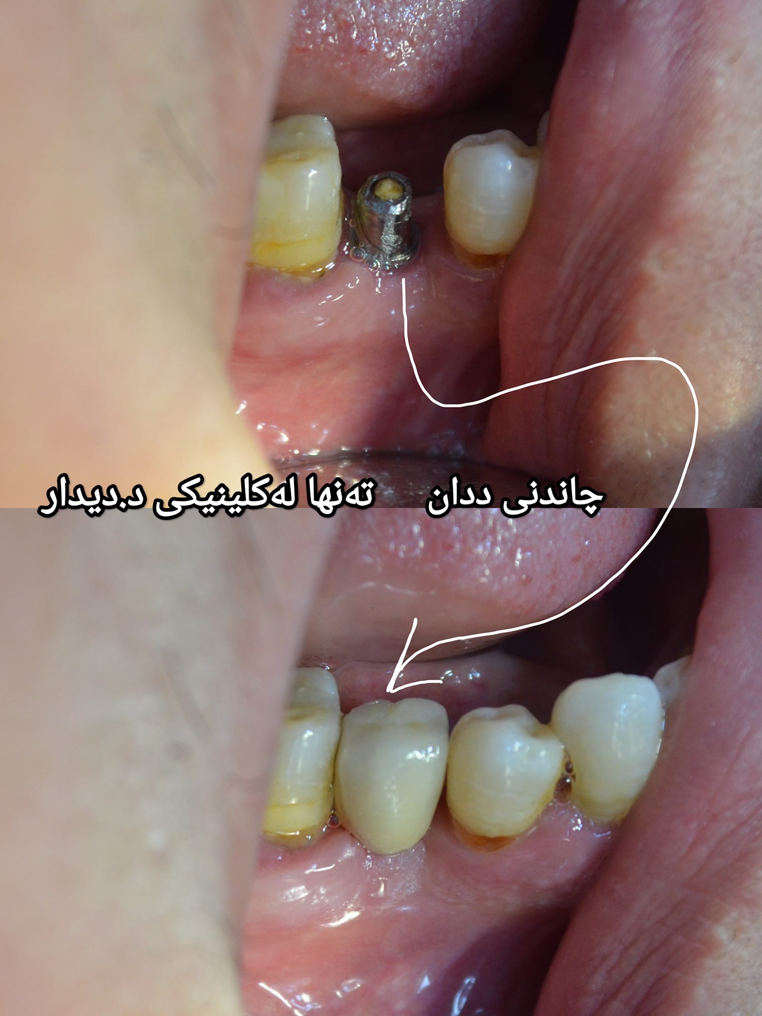دکتۆرە دیدار پزیشکی ددان - د.دیدار عبدالجبار بەکالۆریۆس لەپزیشکی ...