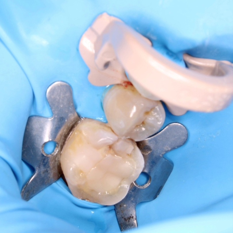Tree Dent Consultorio Dental | Tuxtla Gutiérrez