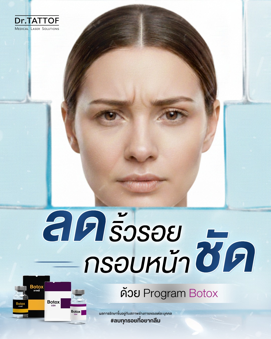 Dr.TATTOF - ⭐️ ลดริ้วรอย กรอบหน้าชัด ด้วย Program Botox เมื่อฉีดไปแล้ว ...