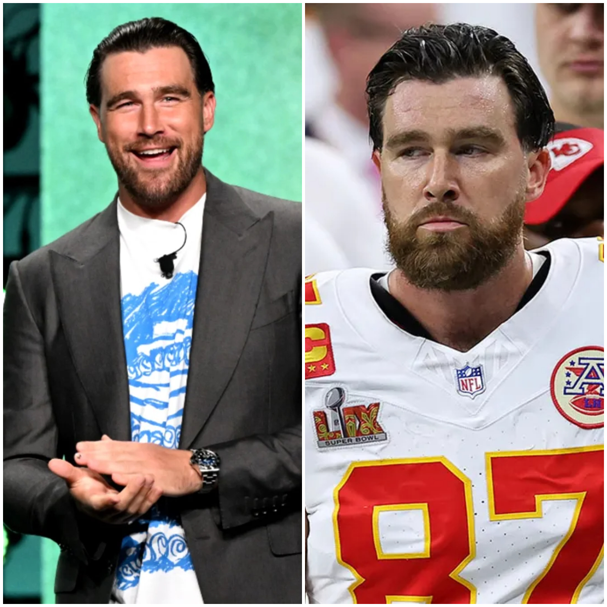 Kansas - UPDATE: Travis Kelce may sign a one-year, $8 million contract ...