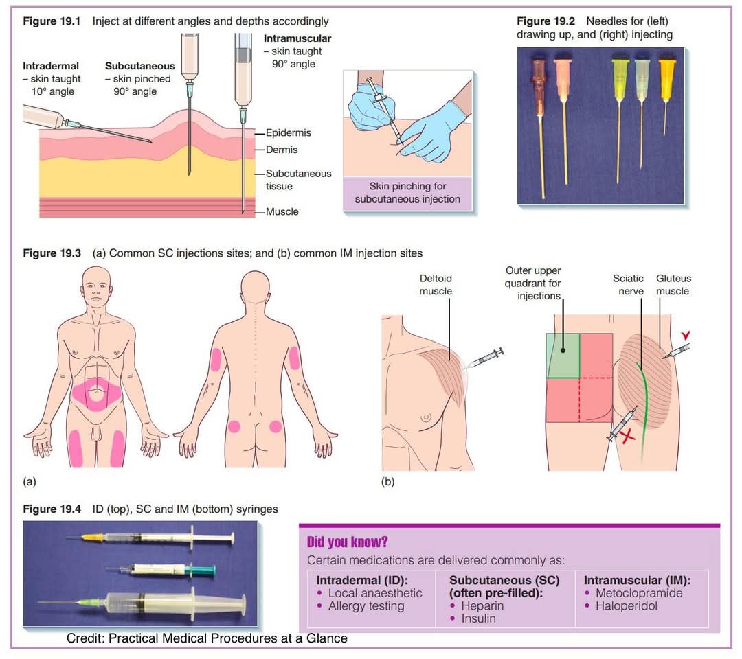 what size needle for b12 injection in arm gauge and length should be used an intramuscular vitamin an adult? How to self-inject intramuscular vitamin