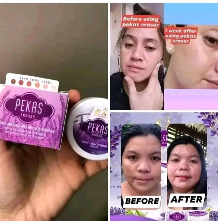 Argen - ONHAND 📣📣 PEKAS Capadosa PEKAS ERASER CREAM!!! Pekas eraser ...