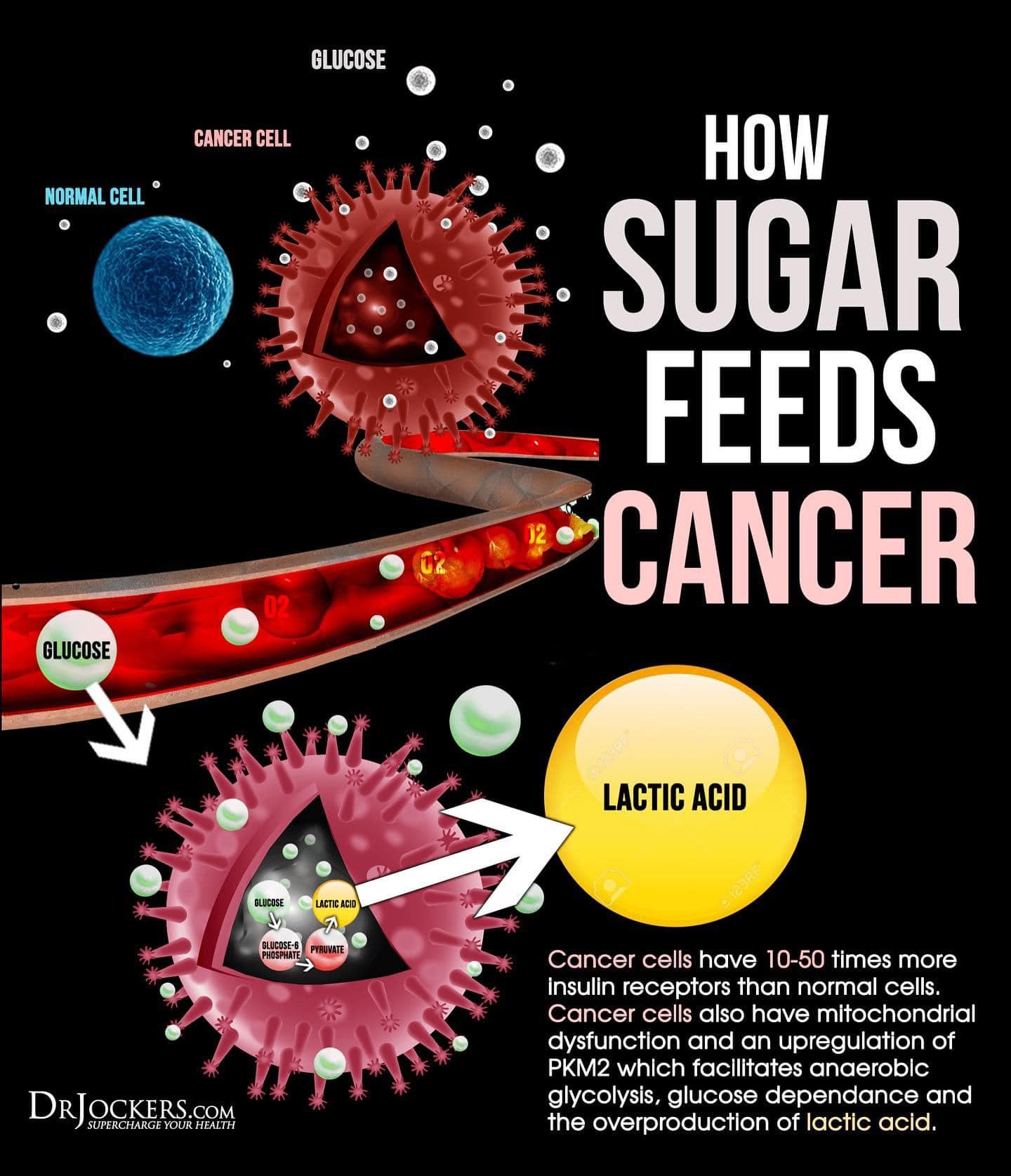 Cancer cells need energy to grow and spread. MD Anderson researchers have been studying how sugar and fat can help fuel that process. One study found sugary drinks may make it easier