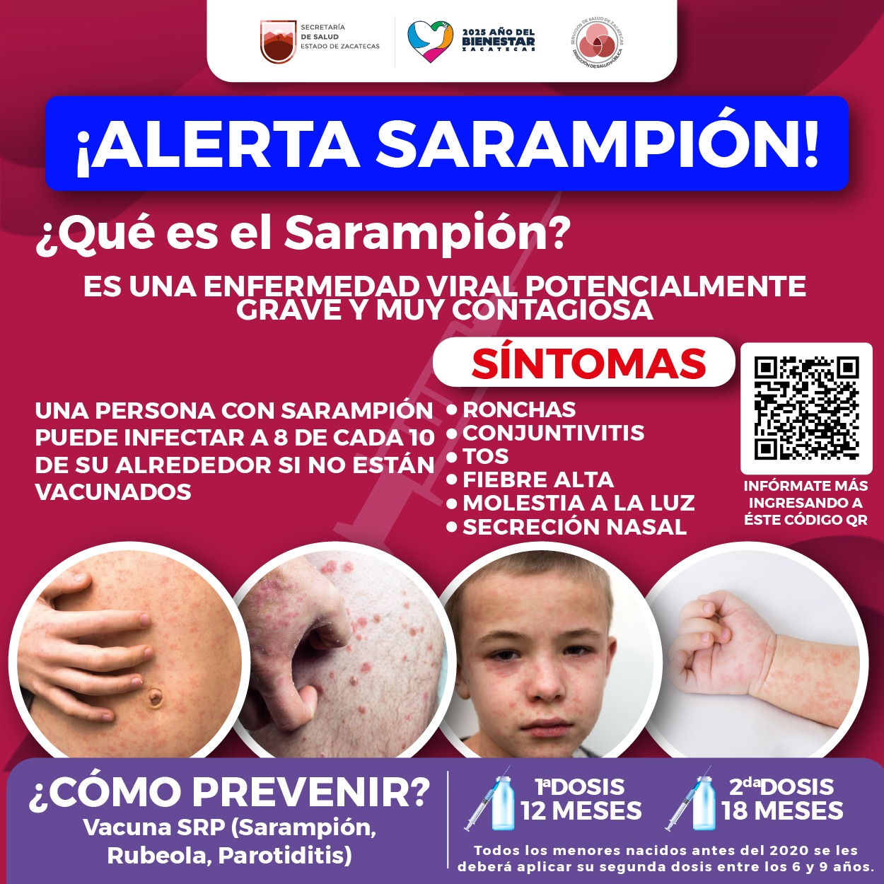 Ayuntamiento - El sarampión es una enfermedad viral que se transmite ...